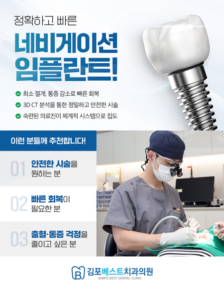 네비게이션임플란트