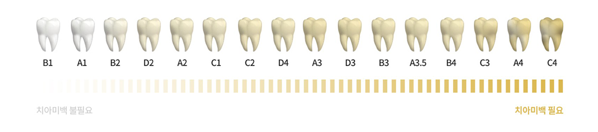 치아색상 가이드